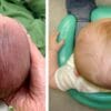 Plagiocefalia: ¿Cómo prevenir y tratar la cada vez más frecuente deformidad de cabeza de los bebés?