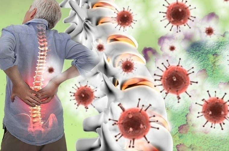 "El dolor crónico de espalda afecta al sistema inmunológico": McGill University de Montreal